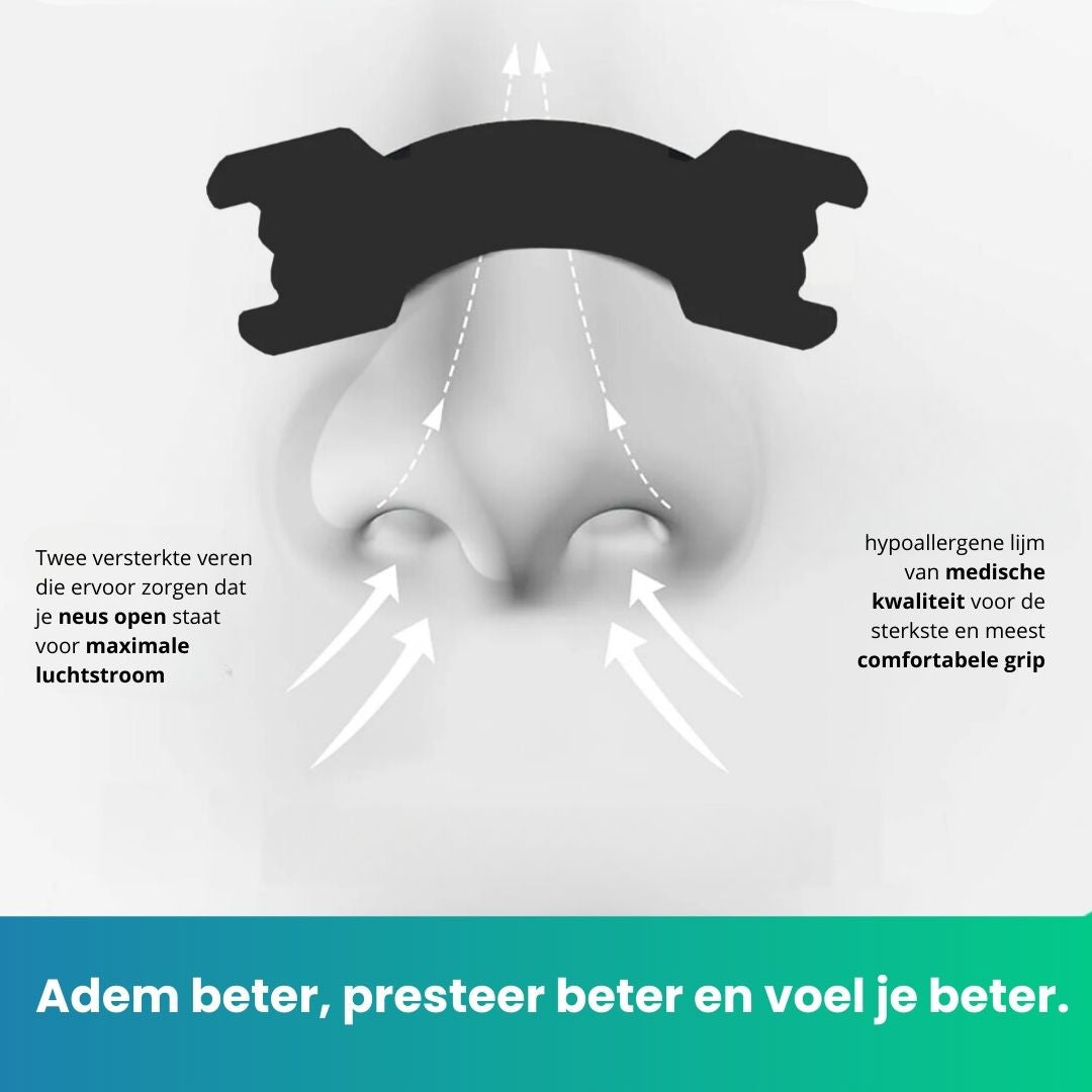 HYSTRIPS Zwart 30 stuks